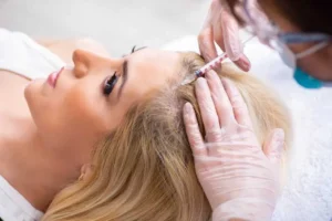 PRF Hair Restoration In Holladay, UT by Muir Medical and Aesthetics LLC